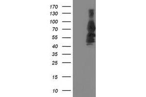 Western Blotting (WB) image for anti-Katanin P80 (WD Repeat Containing) Subunit B 1 (KATNB1) antibody (ABIN1498992) (KATNB1 Antikörper)