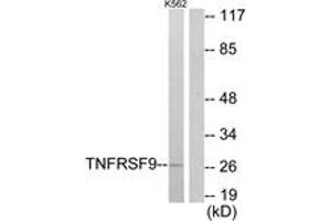 Western blot analysis of extracts from K562 cells, using TNFRSF9 Antibody. (CD137 Antikörper  (AA 101-150))