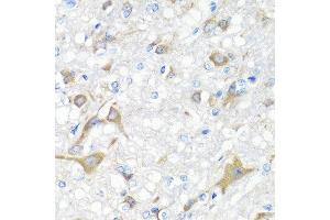 Immunohistochemistry of paraffin-embedded rat brain using IL22 antibody at dilution of 1:100 (40x lens).