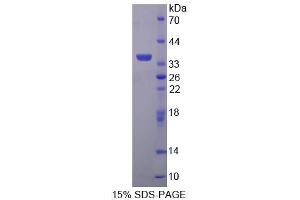 SDS-PAGE analysis of Human TP Protein. (TBXA2R Protein)