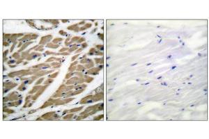 Immunohistochemical analysis of paraffin-embedded human heart tissue using Sodium Channel-pan antibody (ABIN5976507). (Sodium Channel Antikörper  (Internal Region, pan))