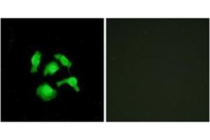 Immunofluorescence analysis of HepG2 cells, using TSC22D1 Antibody . (TSC22D1 Antikörper  (N-Term))