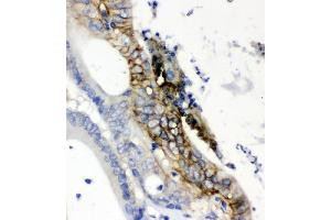 IHC analysis of SLC2A1 using anti-SLC2A1 antibody (ABIN3043927).