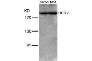 Image no. 3 for anti-Receptor tyrosine-protein kinase erbB-2 (ErbB2/Her2) (Tyr1221), (Tyr1222) antibody (ABIN197225) (ErbB2/Her2 Antikörper  (Tyr1221, Tyr1222))