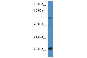 Western Blot showing IL18 antibody used at a concentration of 1 ug/ml against Hela Cell Lysate (IL-18 Antikörper  (C-Term))
