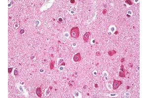 Anti-LC3 antibody IHC of human brain, cortex neurons.