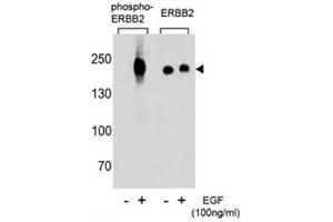 Western blot analysis of extracts from A431 cells, untreated or treated with EGF (100ng/ml), using p-ERBB2 antibody (left) or nonphos Ab (right)