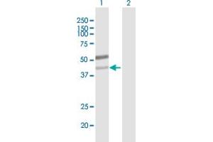 Western Blot analysis of B3GNT6 expression in transfected 293T cell line by B3GNT6 MaxPab polyclonal antibody. (B3GNT6 Antikörper  (AA 1-384))