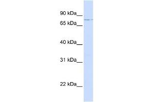 LCP1 antibody used at 1 ug/ml to detect target protein. (LCP1 Antikörper)