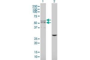 Western Blot analysis of LIPA expression in transfected 293T cell line by LIPA monoclonal antibody (M01), clone 1F9. (Lipase A Antikörper  (AA 1-399))