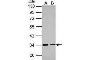 WB Image Sample (30 ug of whole cell lysate) A: A431 B: HeLa 10% SDS PAGE antibody diluted at 1:1000 (ETFA Antikörper  (Center))