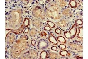 Immunohistochemistry of paraffin-embedded human kidney tissue using ABIN7145071 at dilution of 1:100 (COQ8B Antikörper  (AA 10-137))