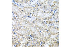 Immunohistochemistry of paraffin-embedded mouse kidney using TARS antibody (ABIN6132713, ABIN6148858, ABIN6148859 and ABIN6222758) at dilution of 1:100 (40x lens).