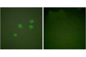 Immunofluorescence analysis of A549 cells, using Cyclin E1 antibody. (Cyclin E1 Antikörper  (Internal Region))