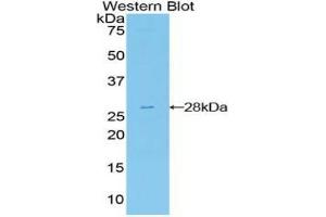 Western blot analysis of the recombinant protein. (FRS2 Antikörper  (AA 239-449))