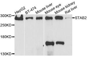 Western blot analysis of extracts of various cell lines, using STAB2 antibody. (Stabilin 2 (STAB2) (AA 1550-1850) Antikörper)