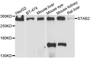Western blot analysis of extracts of various cell lines, using STAB2 antibody.