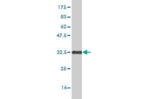 Western Blot detection against Immunogen (33 KDa) . (HOXB7 Antikörper  (AA 55-120))