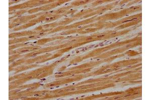 IHC image of ABIN7140227 diluted at 1:700 and staining in paraffin-embedded human heart tissue performed on a Leica BondTM system. (CACNG8 Antikörper  (AA 65-83))