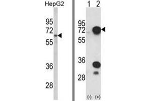 (LEFT) Western blot analysis of HNRPL Antibody (C-term) in HepG2 cell line lysates (35ug/lane). (HNRNPL Antikörper  (C-Term))