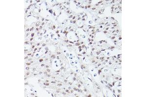 Immunohistochemistry of paraffin-embedded mouse fetal Heart using Islet1 Rabbit mAb (ABIN7268024) at dilution of 1:100 (40x lens). (ISL1 Antikörper)