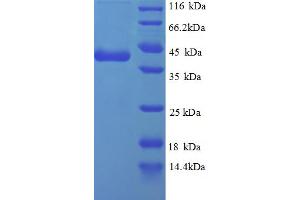 SDS-PAGE (SDS) image for Replication Protein A3, 14kDa (RPA3) (AA 1-119), (partial) protein (GST tag) (ABIN5713006) (RPA3 Protein (AA 1-119, partial) (GST tag))