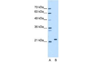 WB Suggested Anti-SDF2 Antibody Titration:  1.