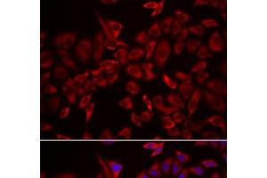 Immunofluorescence analysis of HeLa cells using CSRP3 Polyclonal Antibody (CSRP3 Antikörper)