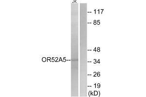 Western blot analysis of extracts from Jurkat cells, using OR52A5 antibody. (OR52A5 Antikörper  (Internal Region))