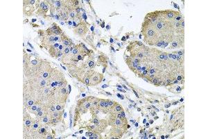 Immunohistochemistry of paraffin-embedded Human stomach using NDUFA6 Polyclonal Antibody at dilution of 1:100 (40x lens).