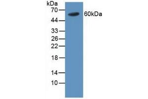 Detection of TRAF4 in Human Blood Cells using Polyclonal Antibody to TNF Receptor Associated Factor 4 (TRAF4) (TRAF4 Antikörper  (AA 193-444))