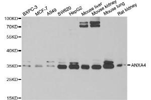 Western blot analysis of extracts of various cell lines, using ANXA4 antibody (ABIN5973706) at 1/1000 dilution. (Annexin IV Antikörper)