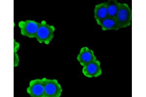 Immunofluorescence analysis of CRC cells using PRKCA antibody (ABIN4904772). (PKC alpha Antikörper)