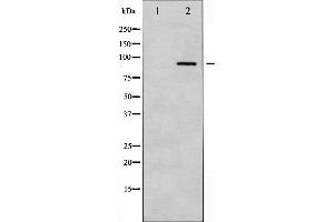 Western blot analysis of PKC alpha expression in UV treated NIH-3T3 whole cell lysates,The lane on the left is treated with the antigen-specific peptide. (PKC alpha Antikörper  (C-Term))