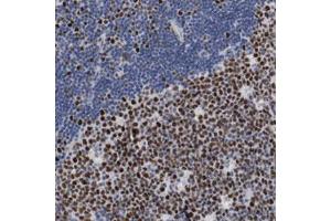 Immunohistochemical staining (Formalin-fixed paraffin-embedded sections) of human lymph node with MCM6 polyclonal antibody  shows strong nuclear positivity in reaction center cells. (MCM6 Antikörper)