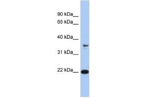 FAIM antibody used at 1 ug/ml to detect target protein.