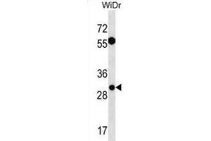 Western Blotting (WB) image for anti-Exosome Component 6 (EXOSC6) antibody (ABIN3000677) (EXOSC6 Antikörper)