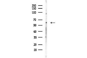 Western blot analysis of lysates from HepG2 cells(LPS,4h treatment), using RAG2 Antibody at 1/1000 dilution.