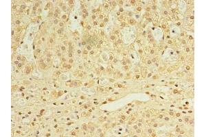 Immunohistochemistry of paraffin-embedded human adrenal gland tissue using ABIN7168458 at dilution of 1:100