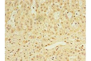 Immunohistochemistry of paraffin-embedded human adrenal gland tissue using ABIN7168458 at dilution of 1:100 (UTP23 Antikörper  (AA 1-249))