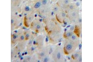 Used in DAB staining on fromalin fixed paraffin-embedded Liver tissue (LILRA2 Antikörper  (AA 217-438))