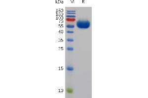 SDS-PAGE (SDS) image for CD200 (CD200) (AA 31-232) protein (Fc Tag) (ABIN7491061)