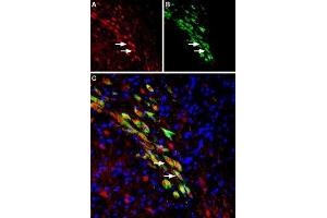Expression of VMAT2 in rat substantia nigra dopaminergic neurons - Immunohistochemical staining of perfusion-fixed frozen rat brain sections using Anti-VMAT2 Antibody (ABIN7043688, ABIN7044610 and ABIN7044611), (1:1000). (SLC18A2 Antikörper  (1st Lumenal Region))