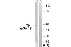 Western Blotting (WB) image for anti-Tyrosine Hydroxylase (TH) (pSer19) antibody (ABIN1847228) (Tyrosine Hydroxylase Antikörper  (pSer19))