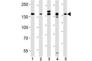 Western blot analysis of lysate from (1) HeLa, (2) MCF-7, (3) mouse C2C12, (4) mouse NIH3T3, (5) rat C6 cell line using Raptor antibody at 1:1000. (RAPTOR Antikörper)