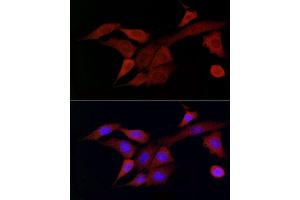 Immunofluorescence (IF) image for anti-Docking Protein 4 (DOK4) (AA 240-326) antibody (ABIN3020722)
