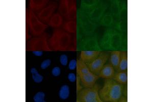 TMEM123 Mouse Monoclonal Antibody staining Hela cells by IF/ICC. (TMEM123 Antikörper)
