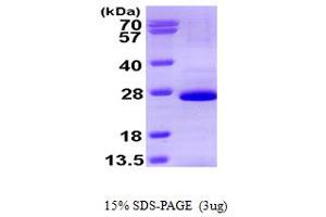 SDS-PAGE (SDS) image for SRY (Sex Determining Region Y)-Box 2 (SOX2) (AA 1-200) protein (His tag) (ABIN666968) (SOX2 Protein (AA 1-200) (His tag))