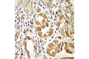 Immunohistochemistry of paraffin-embedded human gastric using RAC1 antibody at dilution of 1:100 (x400 lens).