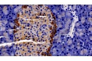 Immunohistochemistry (IHC) image for anti-Prolactin Receptor (PRLR) (AA 20-229) antibody (ABIN7437362)